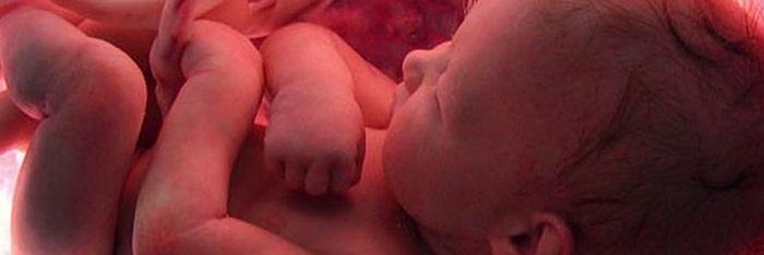 Estimulación sensorial prenatal