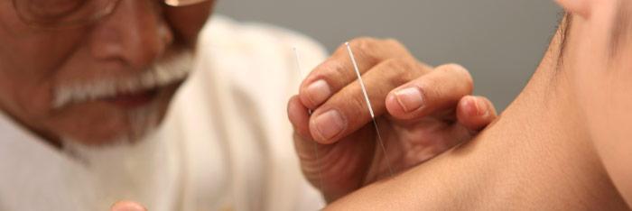 Qué es la acupuntura