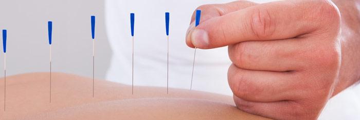 Tratamiento de lesiones medulares con acupuntura