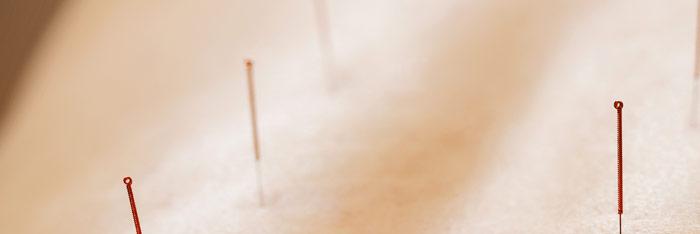 Lesiones medulares y acupuntura II