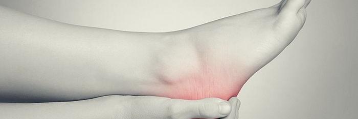 La fascitis plantar