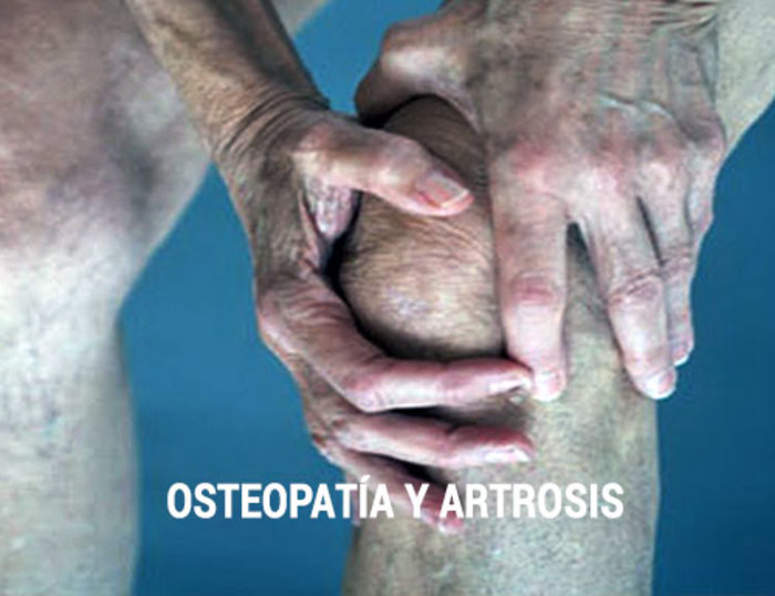 La artrosis en la rodilla