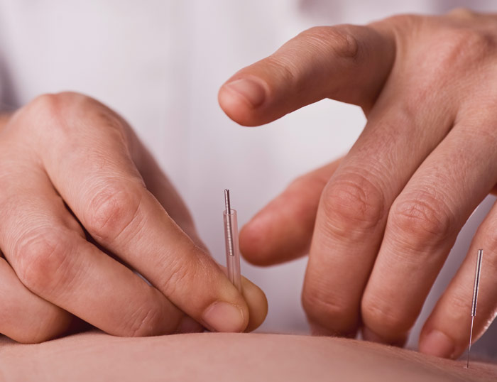 Como tratar la Vaginosis con acupuntura