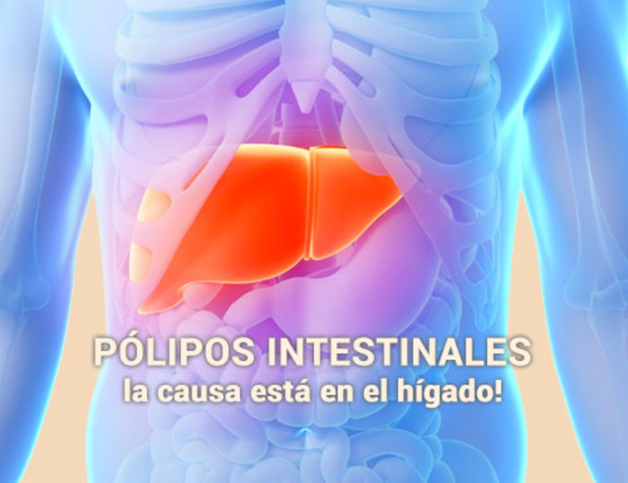 Pólipos intestinales: la causa está en el hígado!