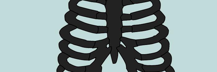 Osteocondritis: Síndrome de Tietze - ¡es la voz de tu corazón!