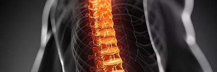 Curvas raquídeas, índice Delmas y dolor lumbar