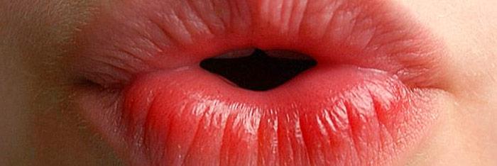 Remodelado de labios