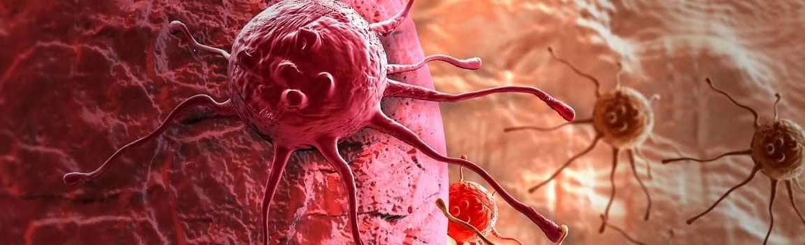 Origen del cancer y como tratarlo con medicina alternativa