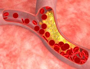 Las mentiras del colesterol