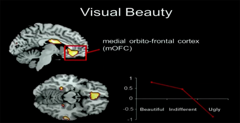 Dr. Samir Zeki, Profesor de Neuroestética del University College London, ha descubierto que, cada vez que vemos algo bello, se ilumina una parte del cerebro, llamada cortex medial orbitofrontal
