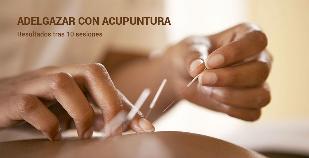 Sesiones de acupuntura para adelgazar: resultados