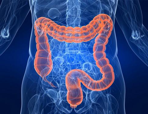 Síndrome del Colon irritable