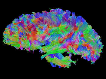 Nutriterapia en el Daño Cerebral Adquirido (DCA)