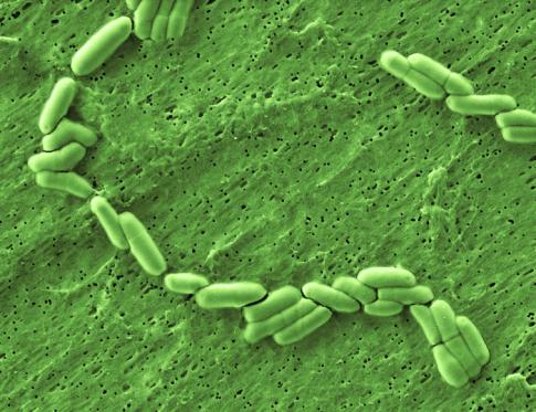 Bifidobacterias las bacterias intestinales amigas