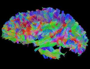 Nutriterapia en el Daño Cerebral Adquirido (DCA)