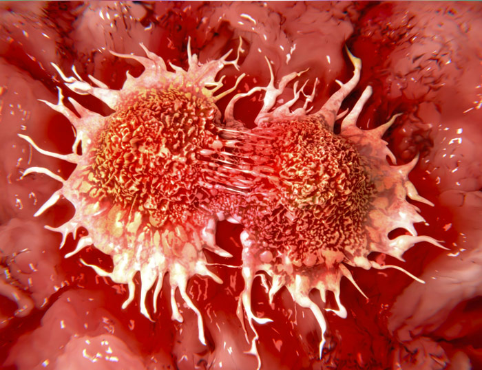 ¿Qué es el cáncer exactamente?