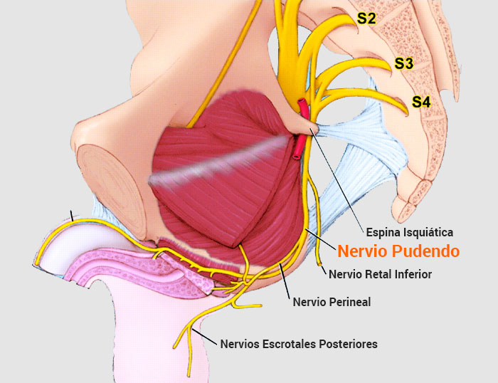 Síndrome de Atrapamiento del Nervio Pudendo