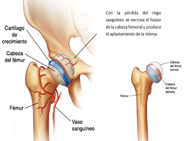 El éxito de la osteopatía