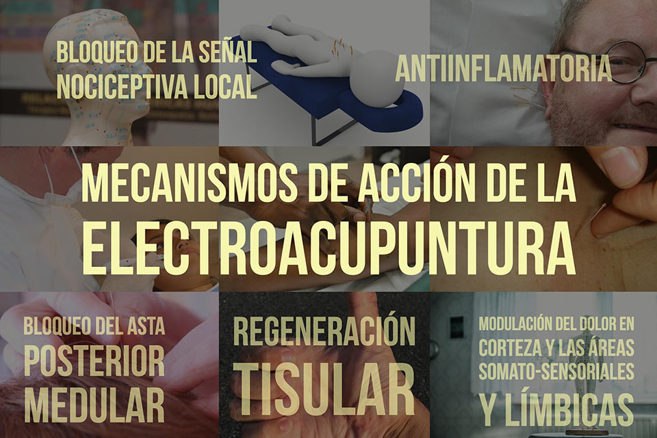 Mecanismos de acción de la electroacupuntura