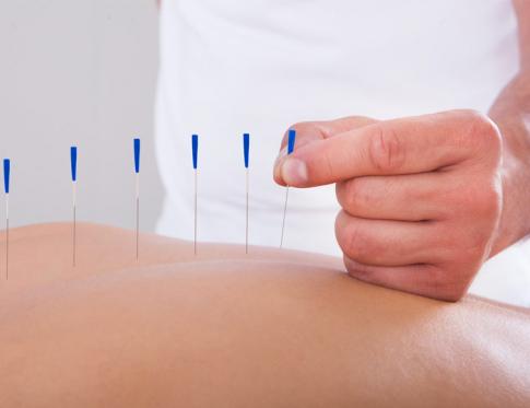 Tratamiento de lesiones medulares utilizando la acupuntura