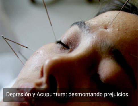Depresión y acupuntura