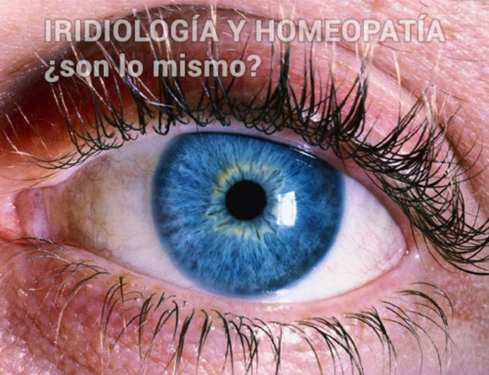 Iridología y Homeopatía: ¿son lo mismo?