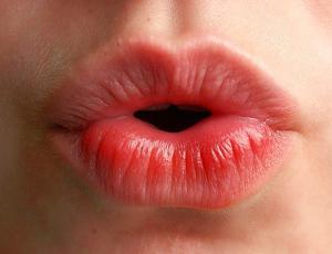 Remodelado de labios