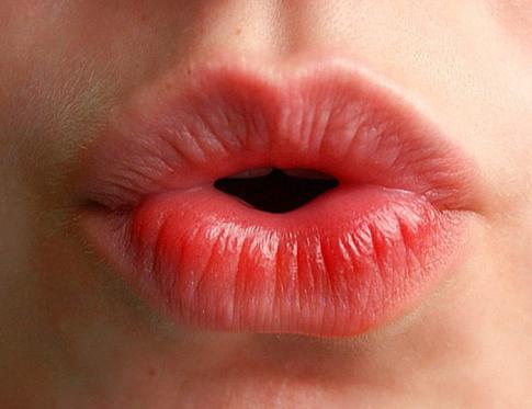 En qué consiste el remodelado de labios