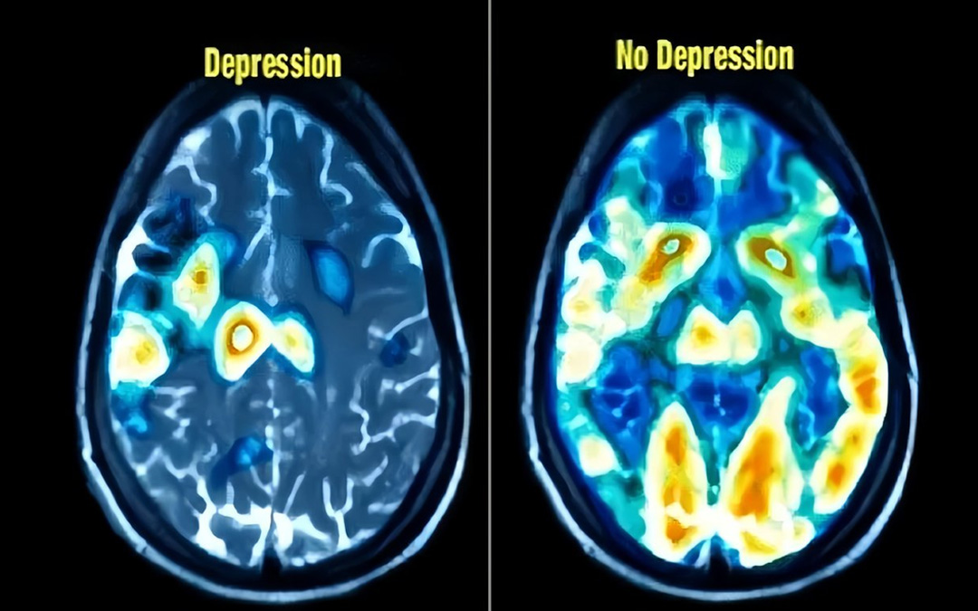 Piensamento positivo vs. negativo