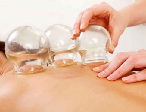 Aplicación de Cupping