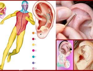 Formación intensiva: Auriculoterapia y Frecuencias de Nogier