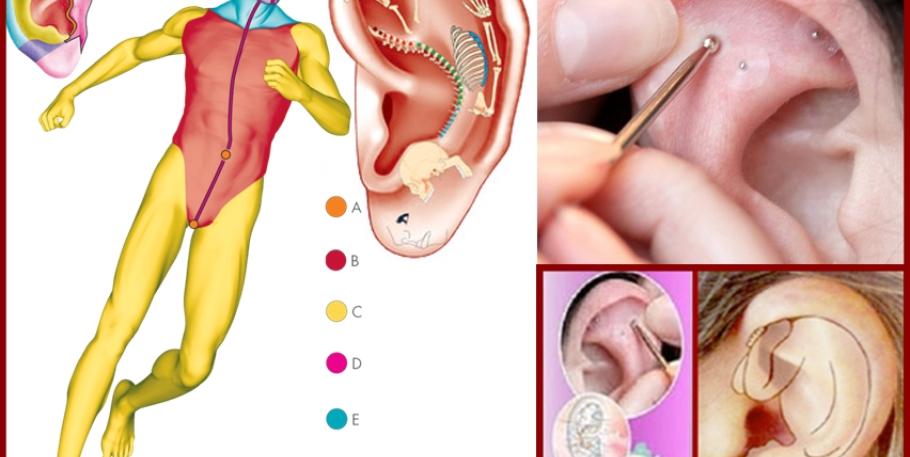 Formación intensiva: Auriculoterapia y Frecuencias de Nogier