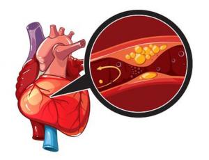 La vitamina P previene el infarto de miocardio y los ictus