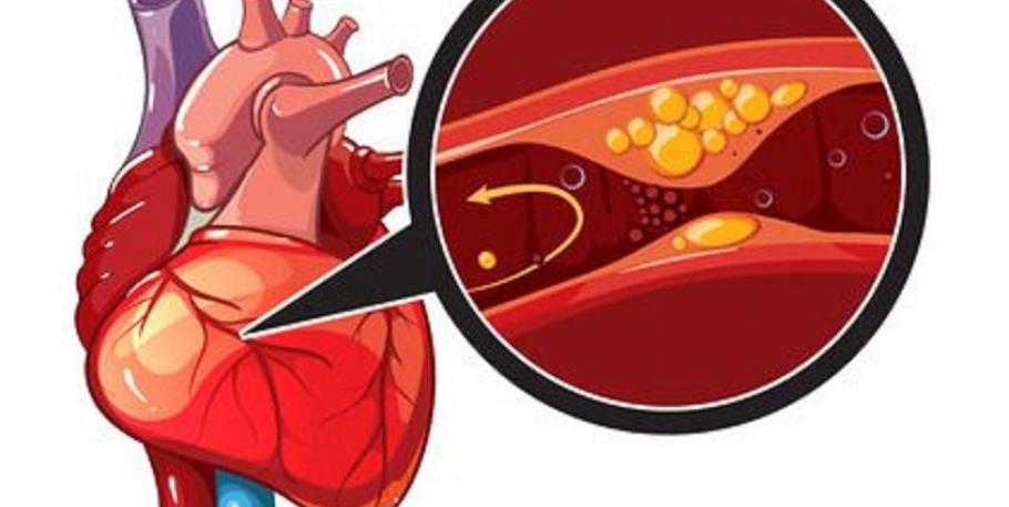 La vitamina P previene el infarto de miocardio y los ictus