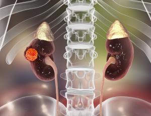 Máster en Medicina China Integrativa en Oncología Tumores Sólidos