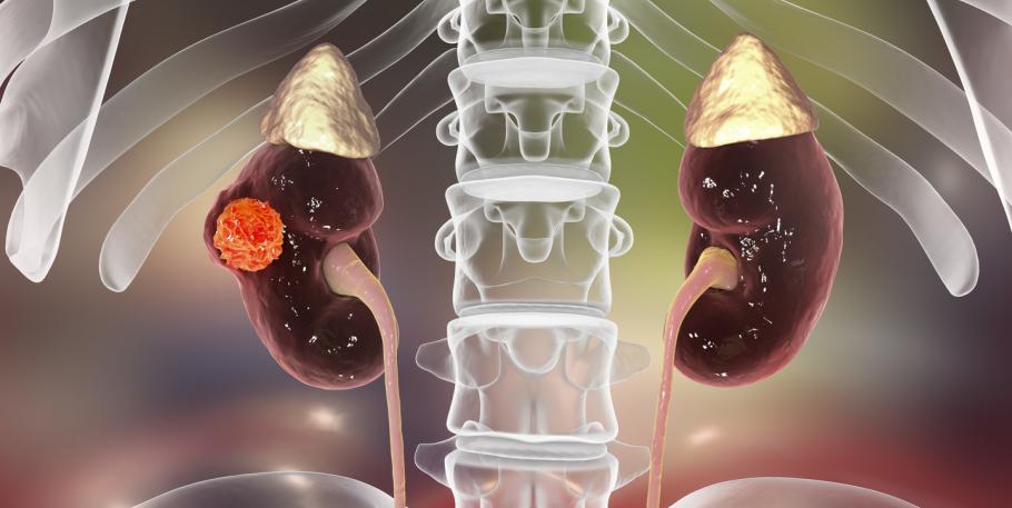 Máster en Medicina China Integrativa en Oncología Tumores Sólidos