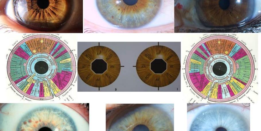 Iridiología - iridiagnosis