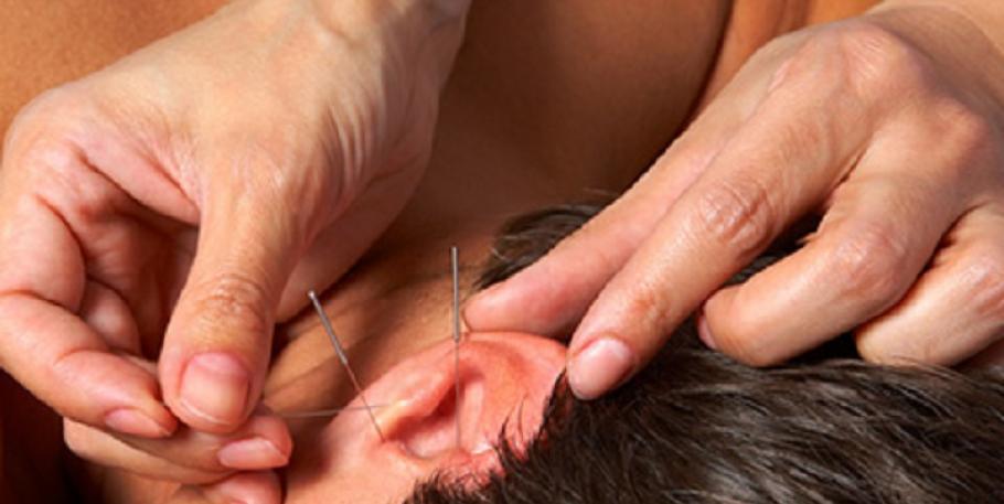 Curso práctico de Auriculopuntura