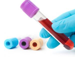 Seminario de interpretación práctica de análisis de sangre