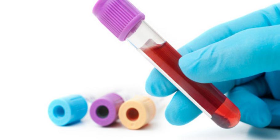 Seminario de interpretación práctica de análisis de sangre